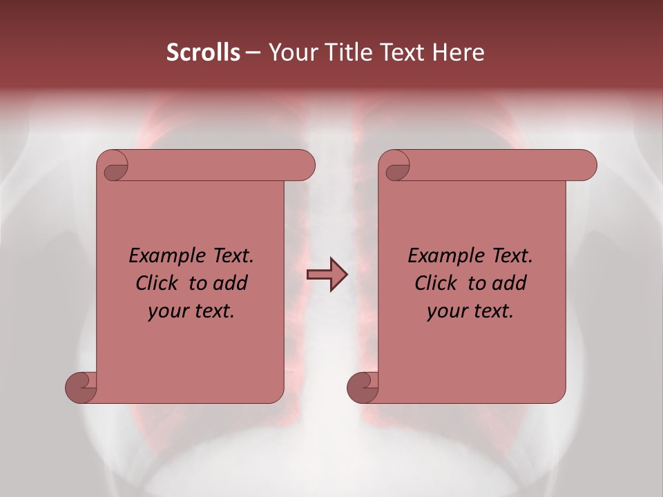 Exam Bronchitis Pulmonary PowerPoint Template