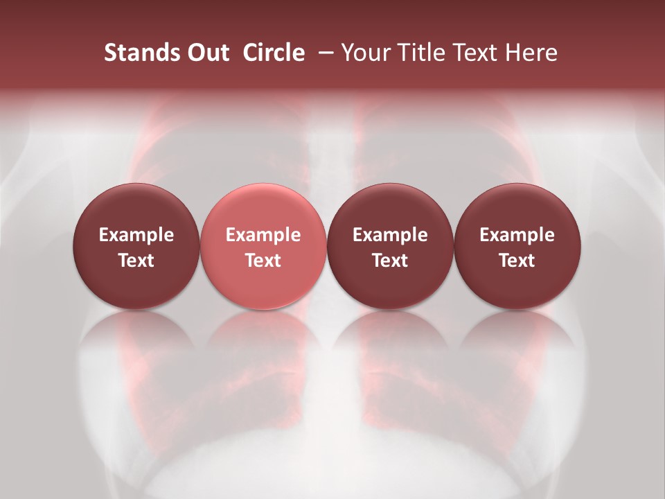 Exam Bronchitis Pulmonary PowerPoint Template