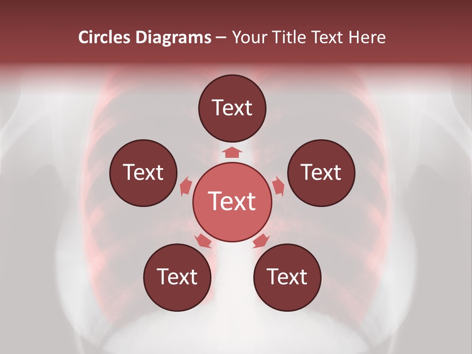 Exam Bronchitis Pulmonary PowerPoint Template