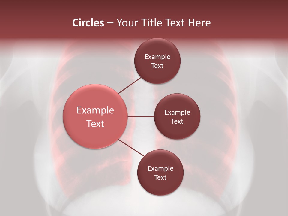 Exam Bronchitis Pulmonary PowerPoint Template