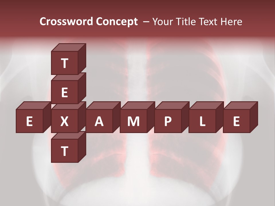 Exam Bronchitis Pulmonary PowerPoint Template