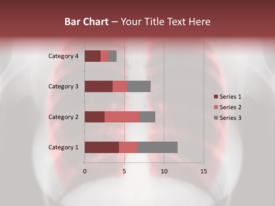 Exam Bronchitis Pulmonary PowerPoint Template