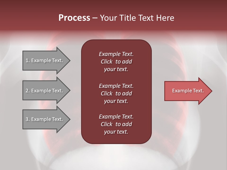 Exam Bronchitis Pulmonary PowerPoint Template