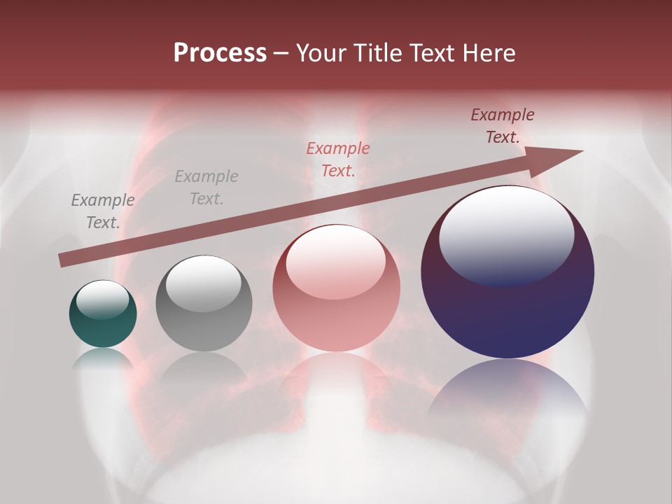 Exam Bronchitis Pulmonary PowerPoint Template