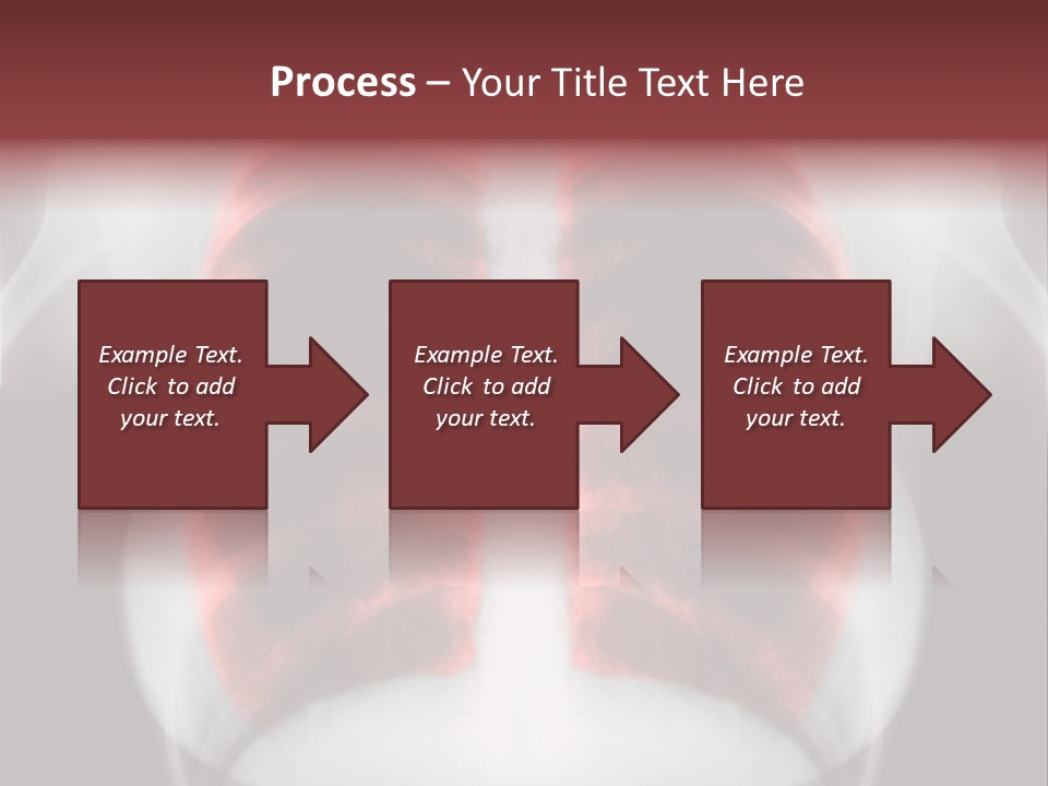 Exam Bronchitis Pulmonary PowerPoint Template