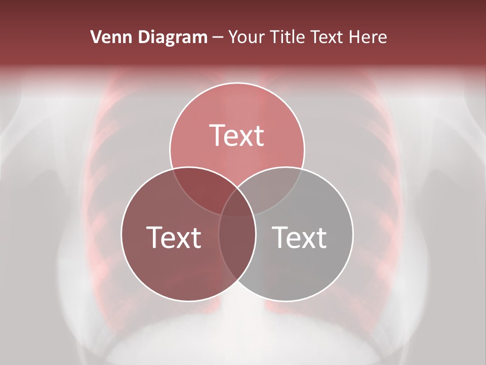 Exam Bronchitis Pulmonary PowerPoint Template