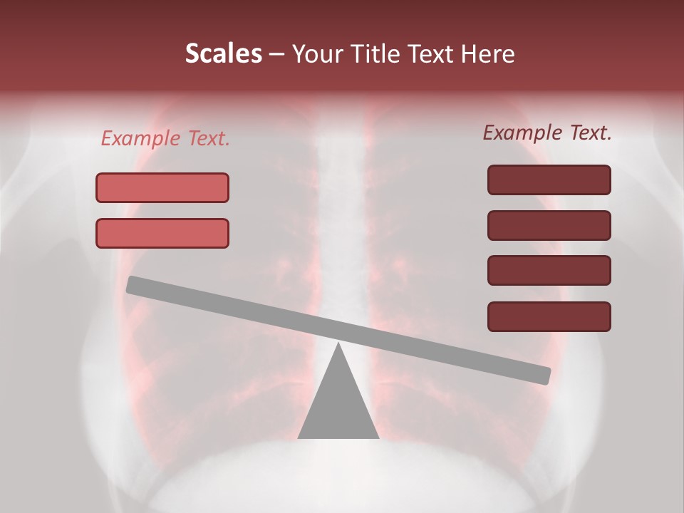 Exam Bronchitis Pulmonary PowerPoint Template