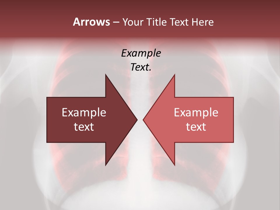 Exam Bronchitis Pulmonary PowerPoint Template