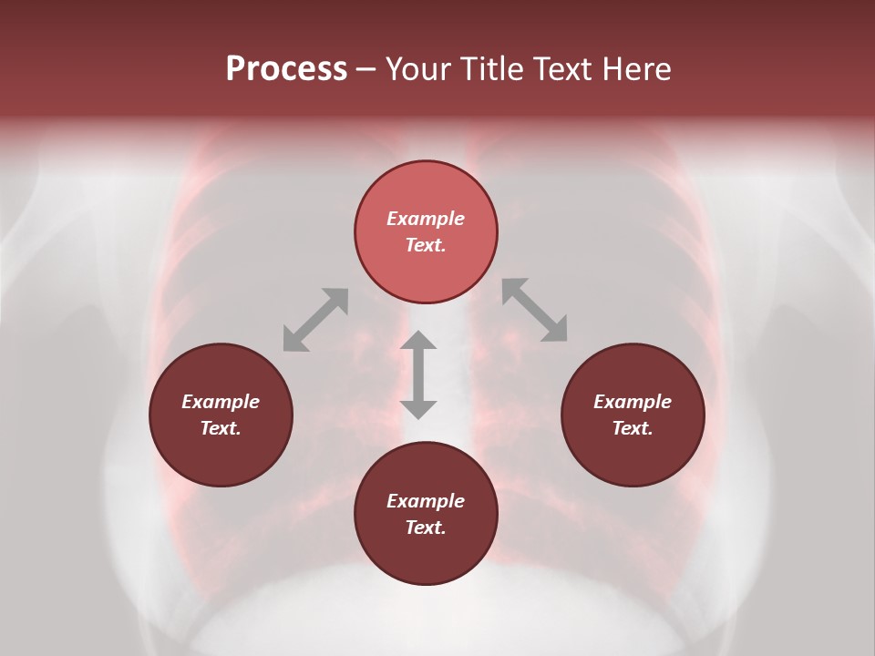 Exam Bronchitis Pulmonary PowerPoint Template