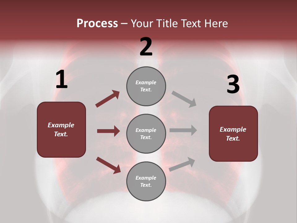 Exam Bronchitis Pulmonary PowerPoint Template