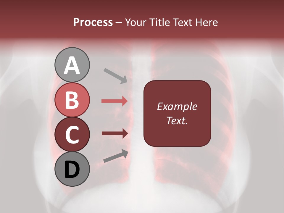 Exam Bronchitis Pulmonary PowerPoint Template