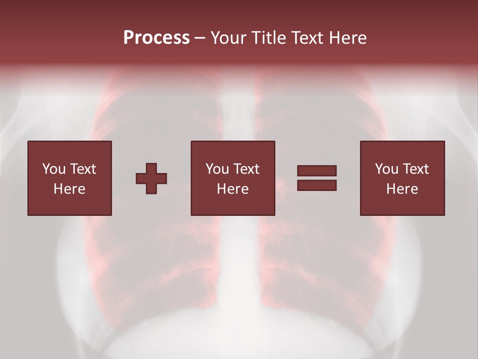 Exam Bronchitis Pulmonary PowerPoint Template