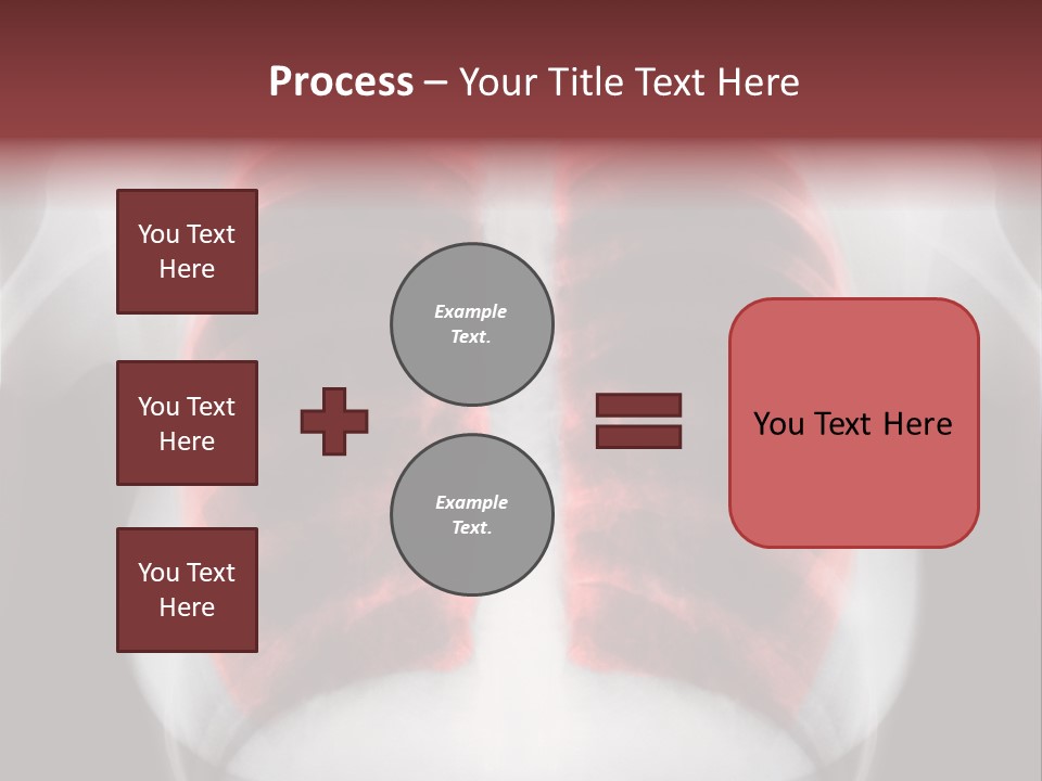 Exam Bronchitis Pulmonary PowerPoint Template