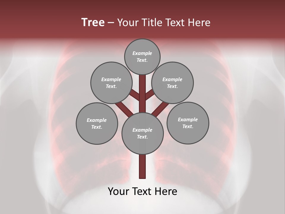 Exam Bronchitis Pulmonary PowerPoint Template