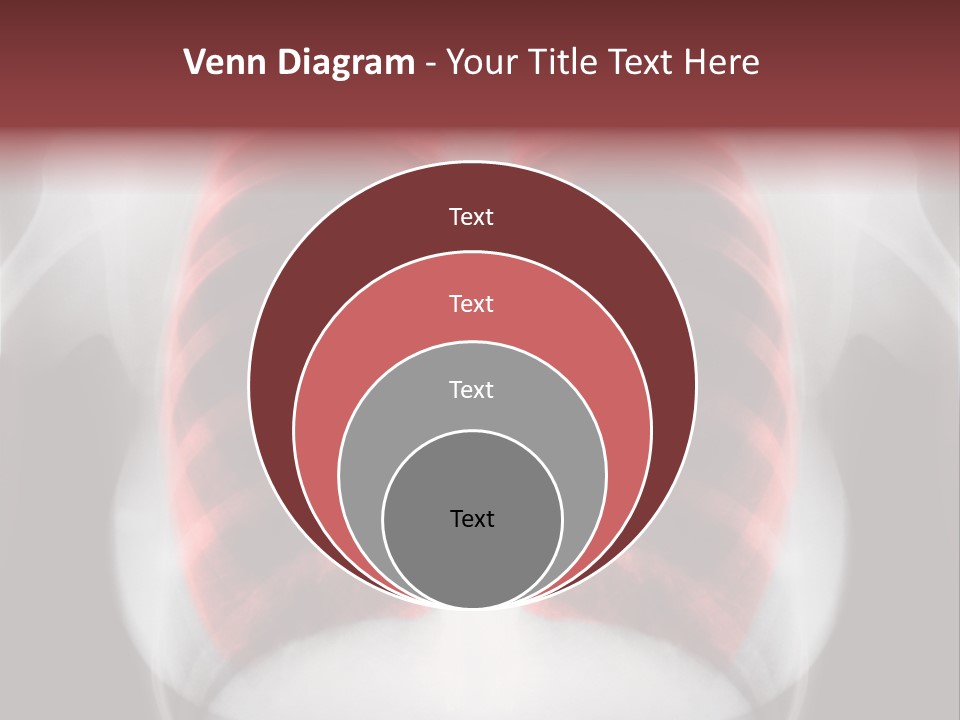 Exam Bronchitis Pulmonary PowerPoint Template