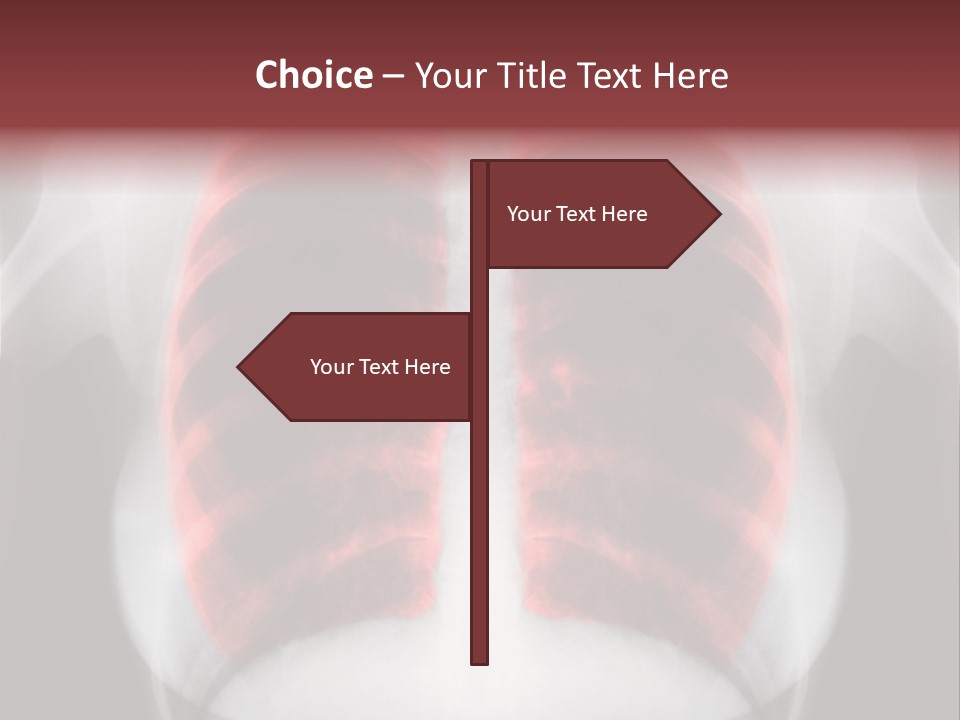 Exam Bronchitis Pulmonary PowerPoint Template