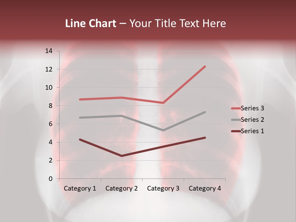Exam Bronchitis Pulmonary PowerPoint Template