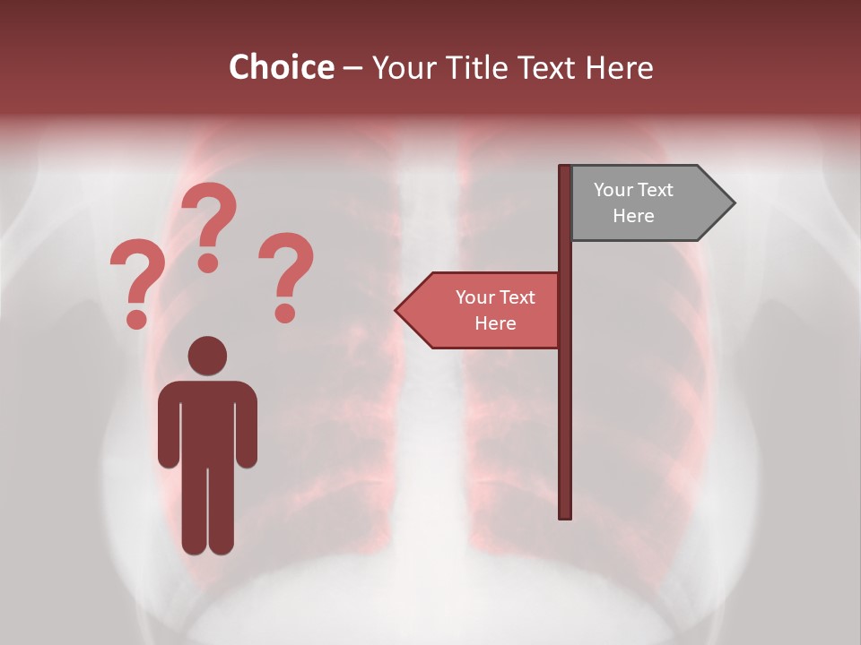 Exam Bronchitis Pulmonary PowerPoint Template