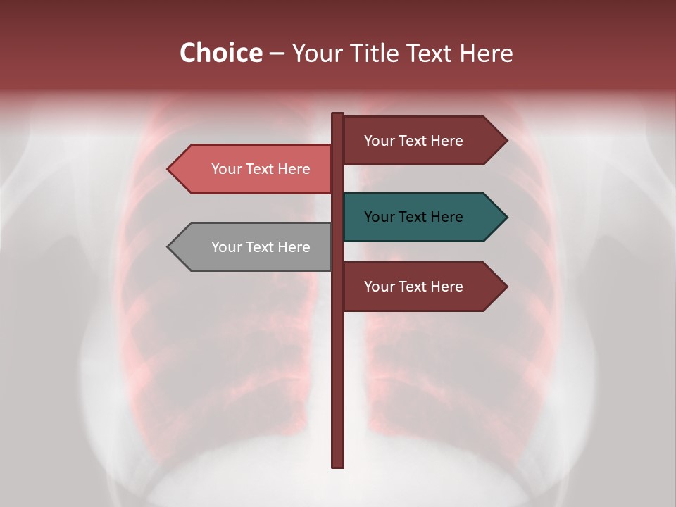 Exam Bronchitis Pulmonary PowerPoint Template
