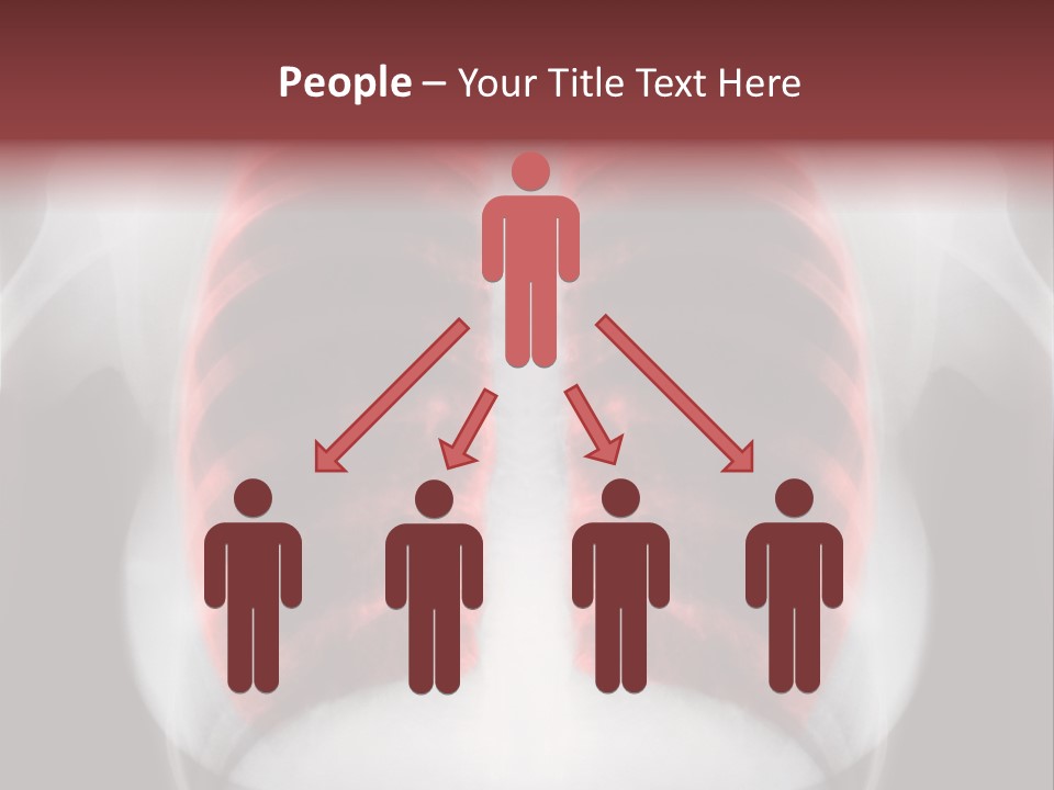 Exam Bronchitis Pulmonary PowerPoint Template