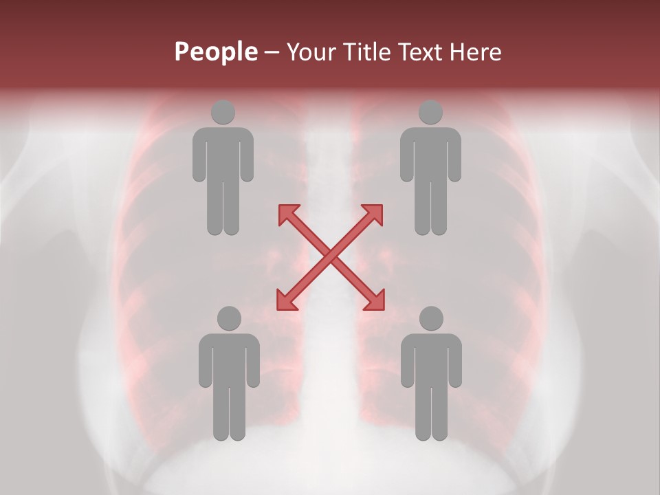 Exam Bronchitis Pulmonary PowerPoint Template