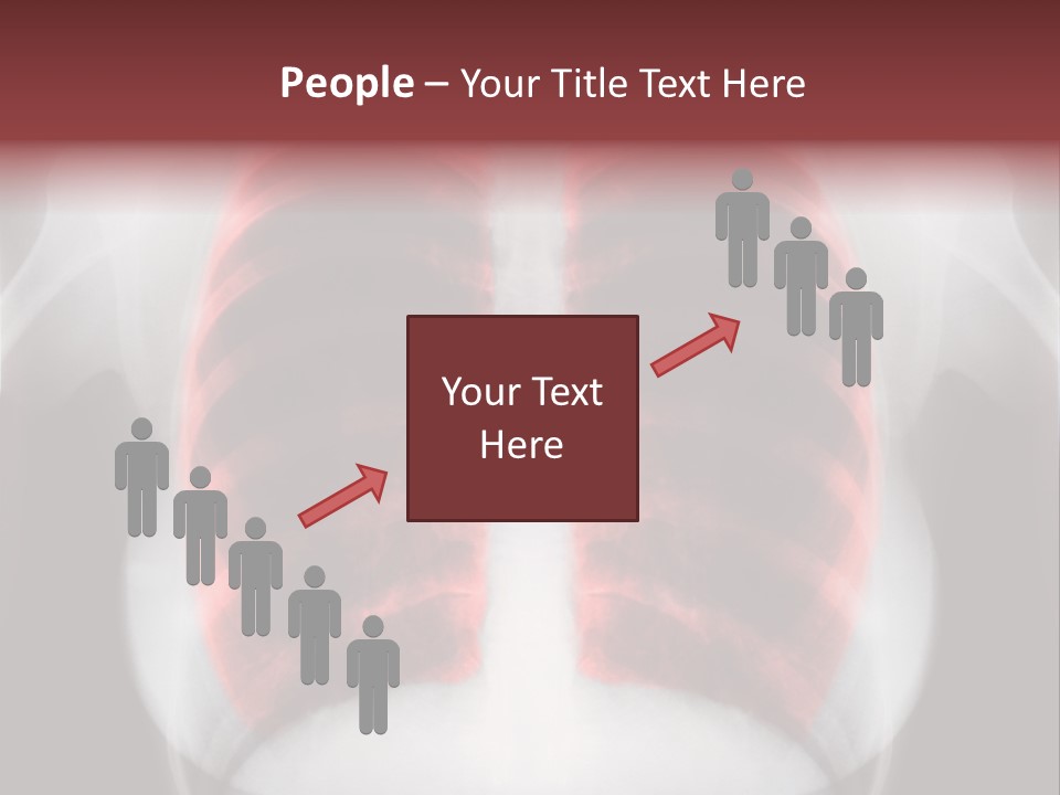 Exam Bronchitis Pulmonary PowerPoint Template