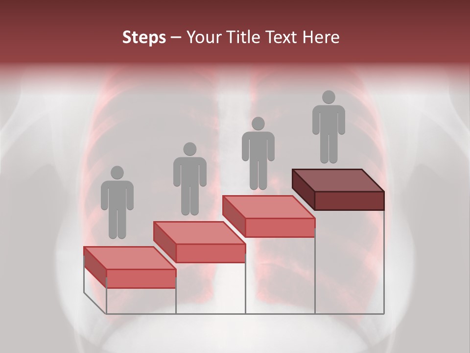 Exam Bronchitis Pulmonary PowerPoint Template