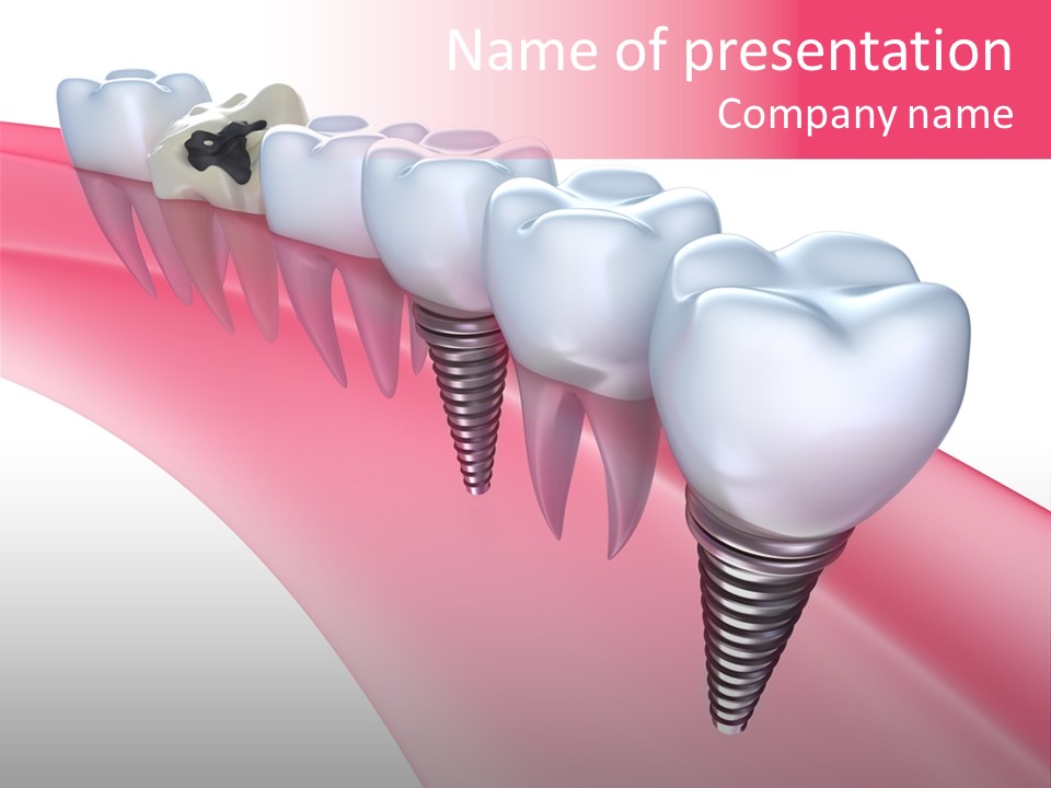 Treatment Prosthesis Isolated PowerPoint Template