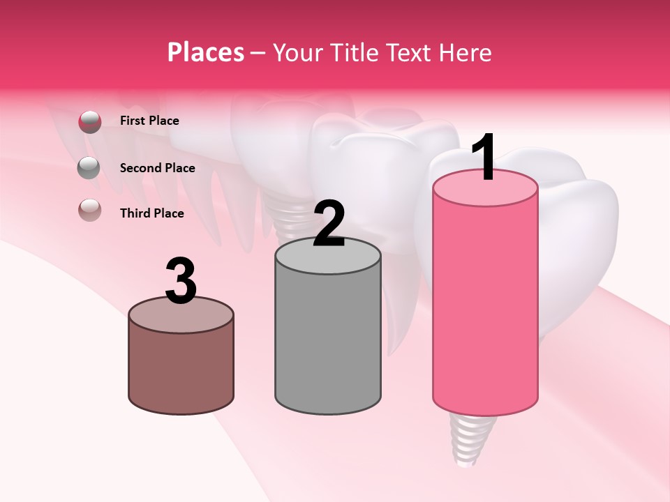Treatment Prosthesis Isolated PowerPoint Template