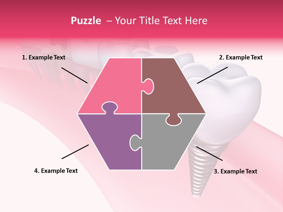 Treatment Prosthesis Isolated PowerPoint Template