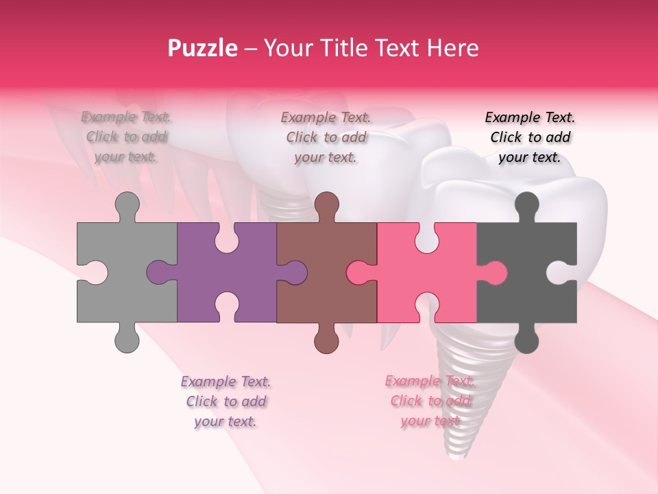 Treatment Prosthesis Isolated PowerPoint Template