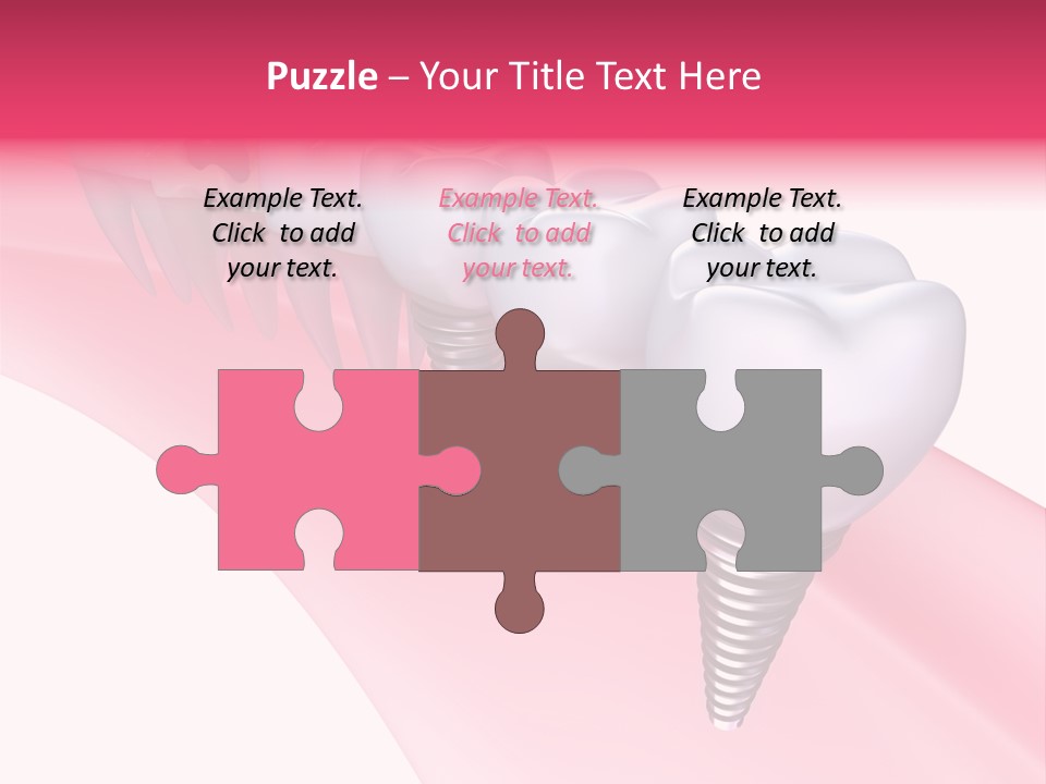 Treatment Prosthesis Isolated PowerPoint Template