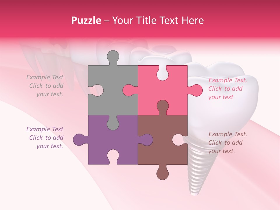 Treatment Prosthesis Isolated PowerPoint Template