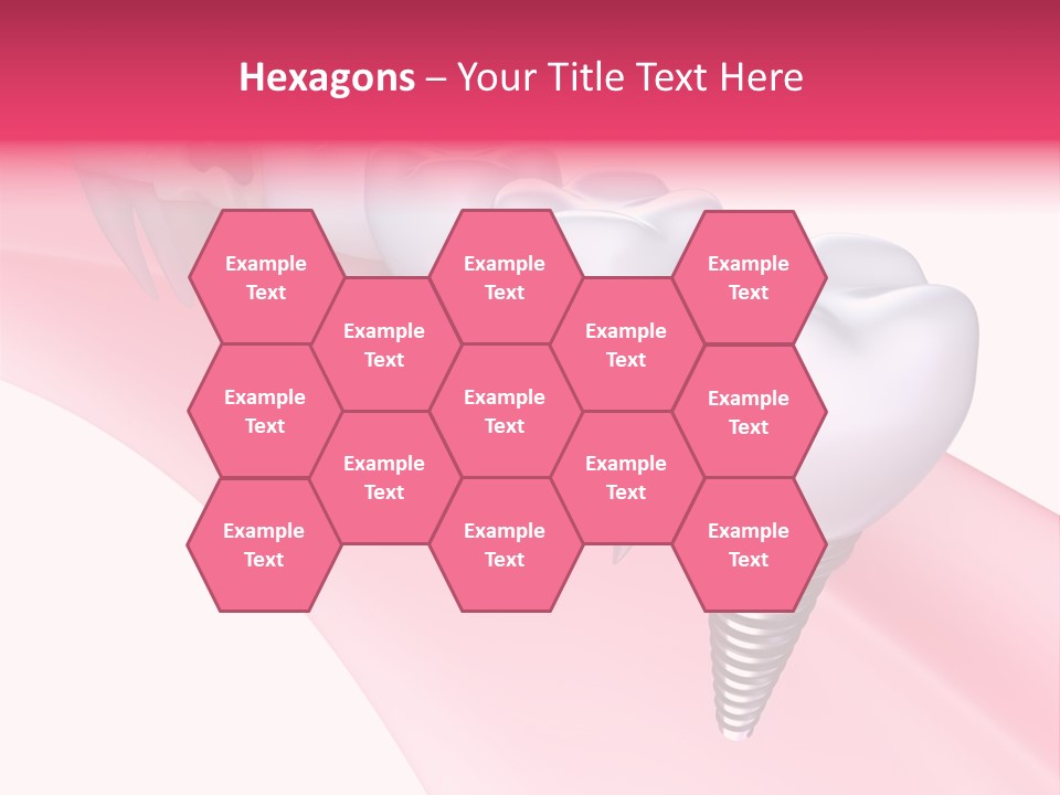 Treatment Prosthesis Isolated PowerPoint Template