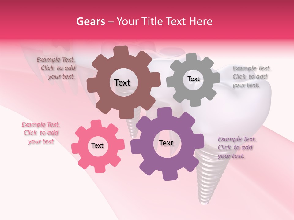 Treatment Prosthesis Isolated PowerPoint Template