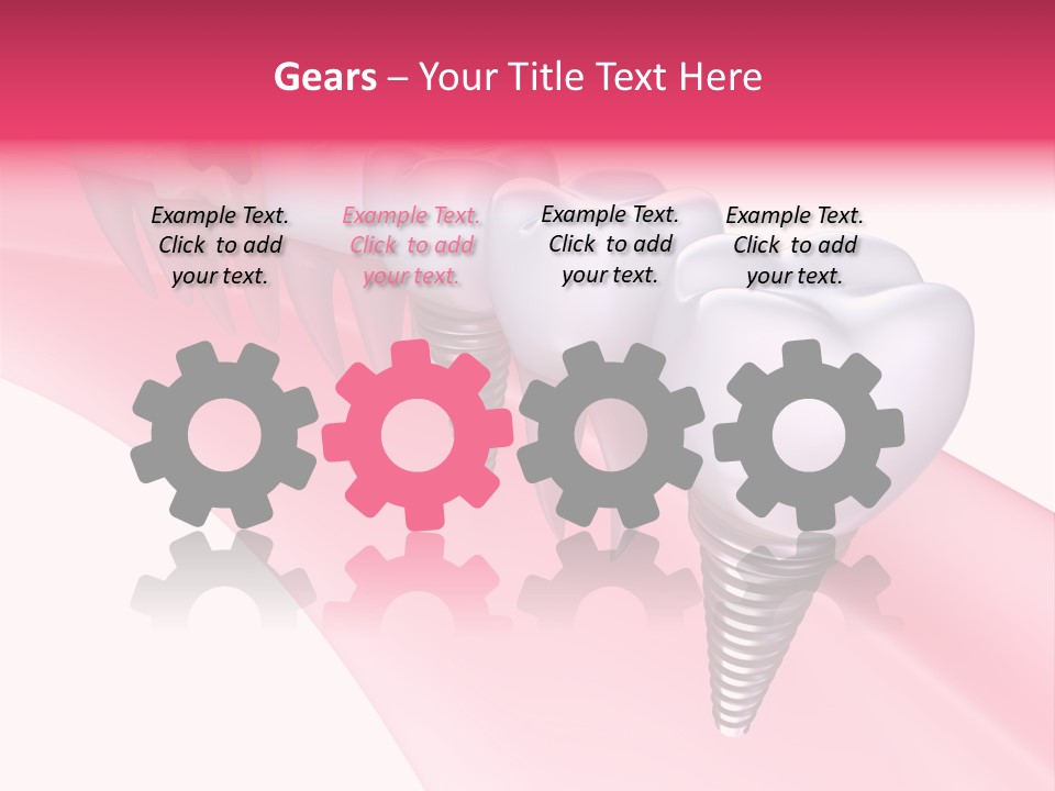 Treatment Prosthesis Isolated PowerPoint Template