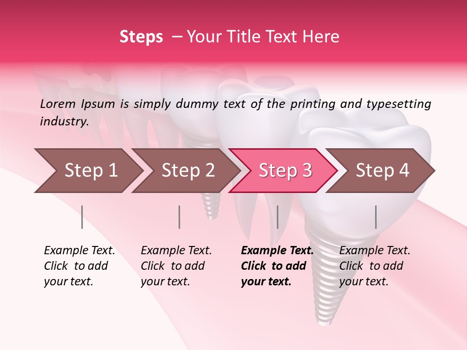 Treatment Prosthesis Isolated PowerPoint Template