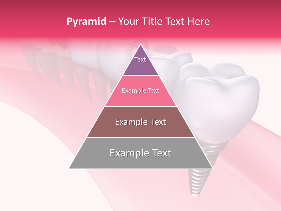 Treatment Prosthesis Isolated PowerPoint Template