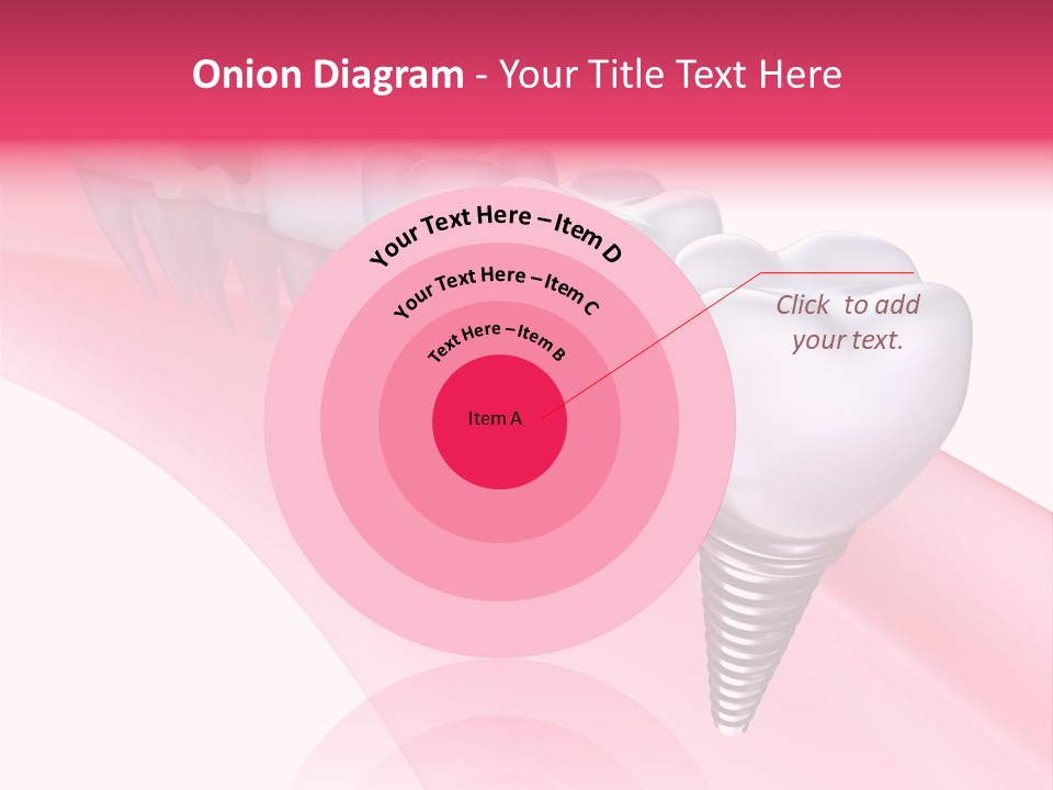 Treatment Prosthesis Isolated PowerPoint Template