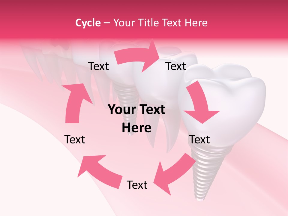 Treatment Prosthesis Isolated PowerPoint Template