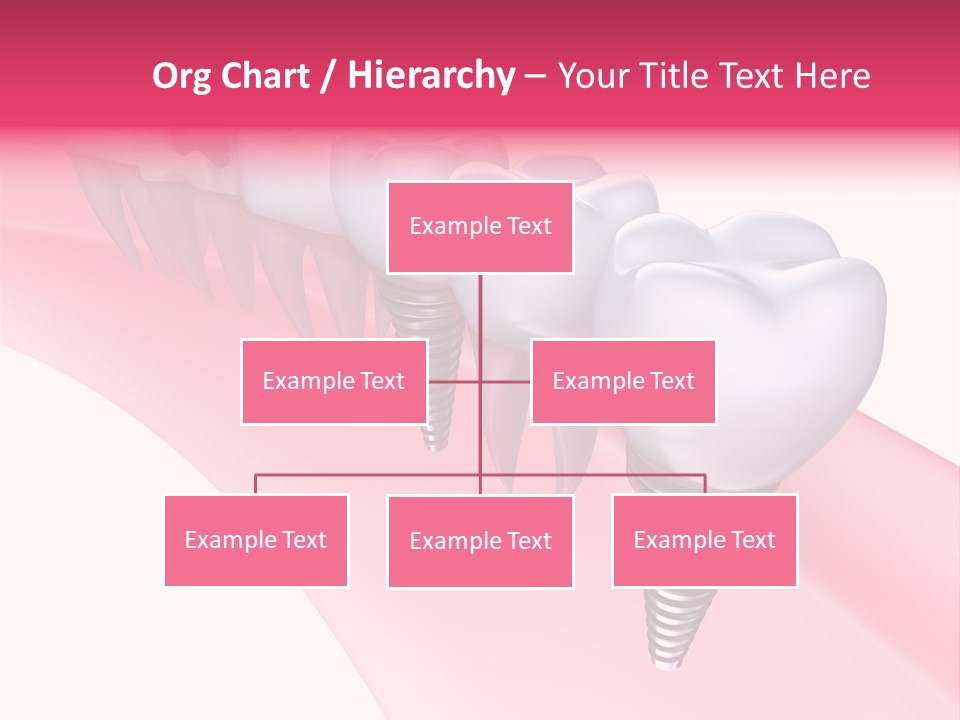 Treatment Prosthesis Isolated PowerPoint Template