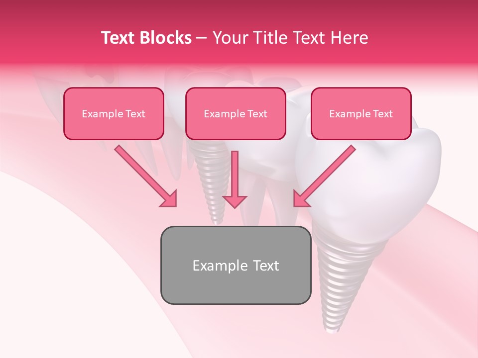 Treatment Prosthesis Isolated PowerPoint Template