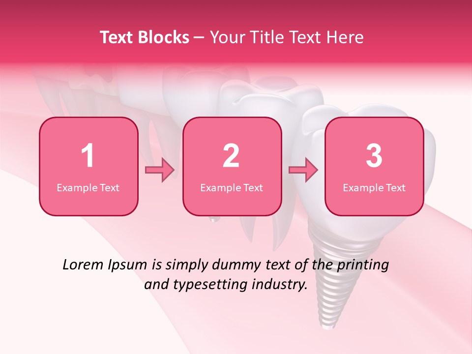 Treatment Prosthesis Isolated PowerPoint Template