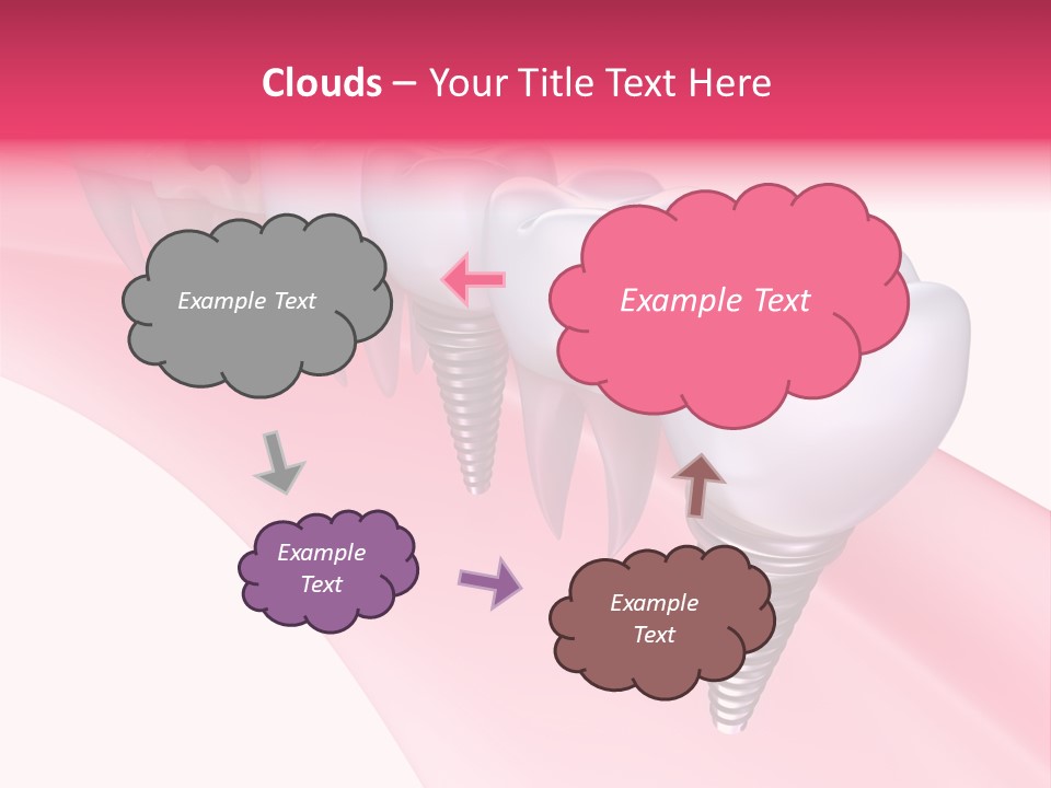 Treatment Prosthesis Isolated PowerPoint Template