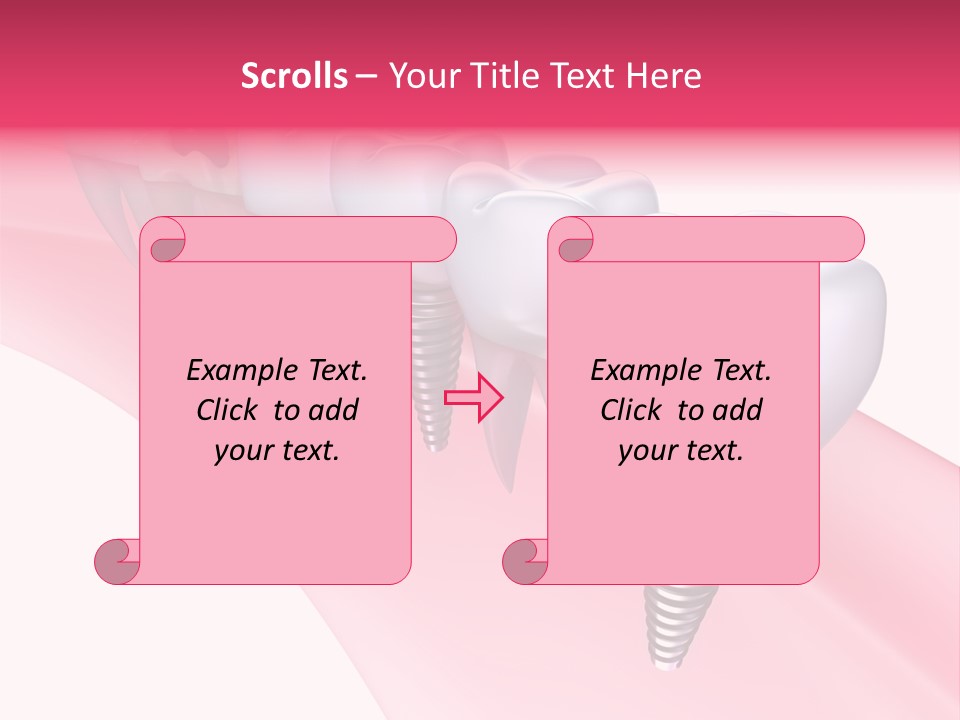 Treatment Prosthesis Isolated PowerPoint Template