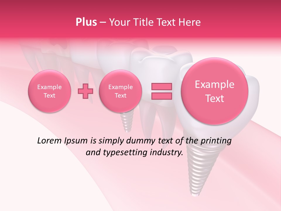 Treatment Prosthesis Isolated PowerPoint Template