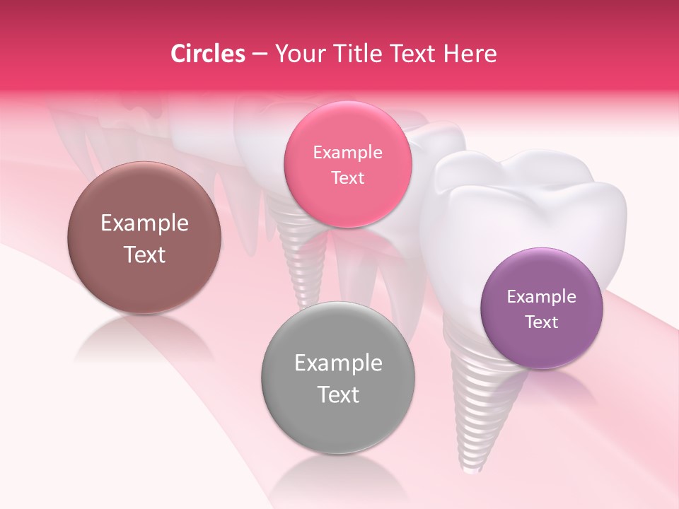 Treatment Prosthesis Isolated PowerPoint Template