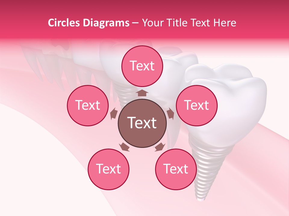 Treatment Prosthesis Isolated PowerPoint Template