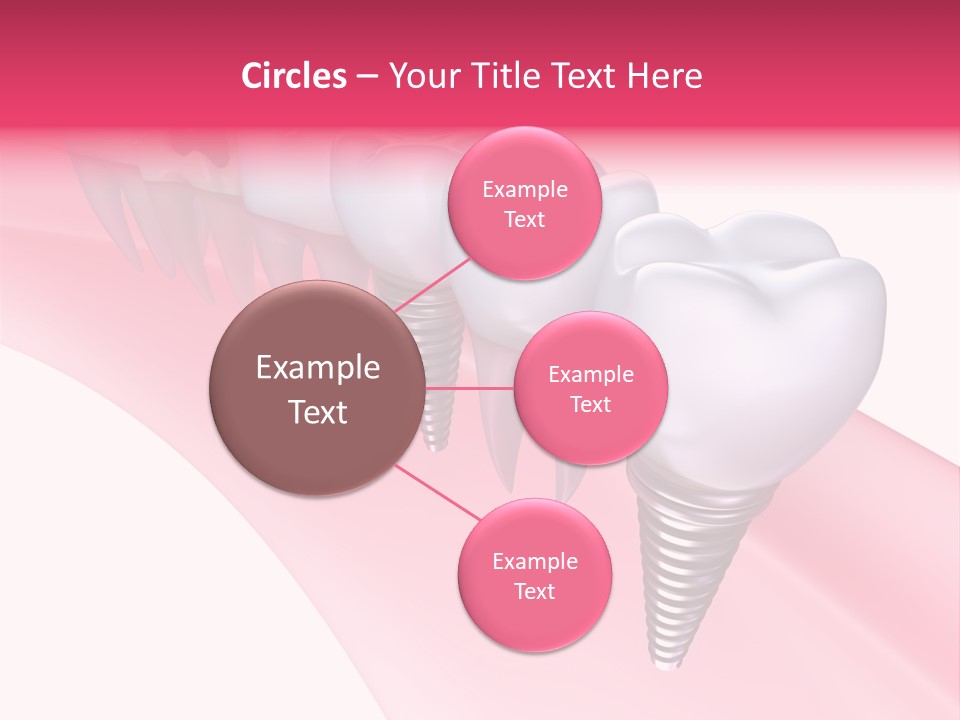 Treatment Prosthesis Isolated PowerPoint Template