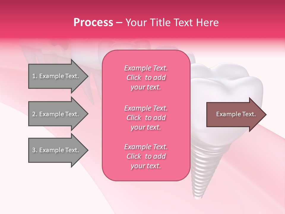 Treatment Prosthesis Isolated PowerPoint Template